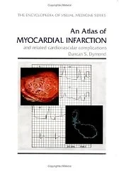 An Atlas of Myocardial Infarction and Related Cardiovascular ComplicationsDymond, D.S.