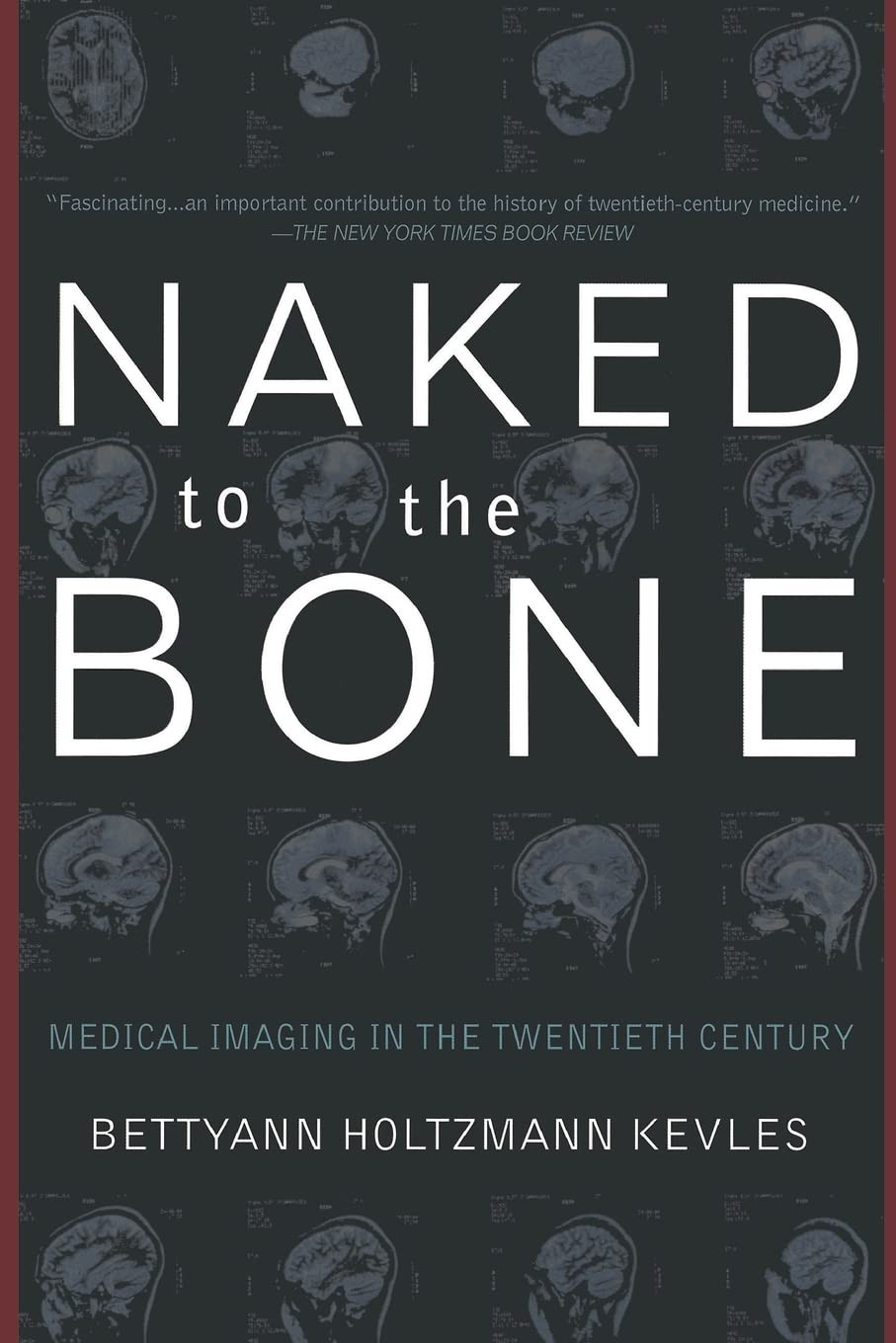 Naked To The Bone: Medical Imaging In The Twentieth Century by: Kevles, Bettyann H.